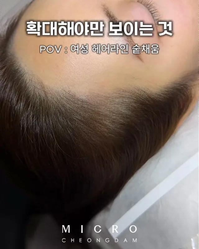 근접 · 여성 헤어라인 가까이서 본 모습