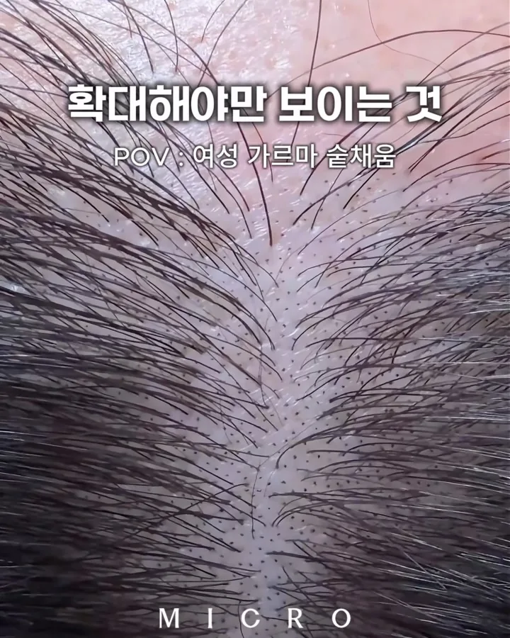 근접 · 여성 가르마 가까이서 본 모습